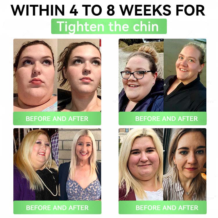 Daily Slim Patch — Melt Fat, Boost Metabolism! - Image 3