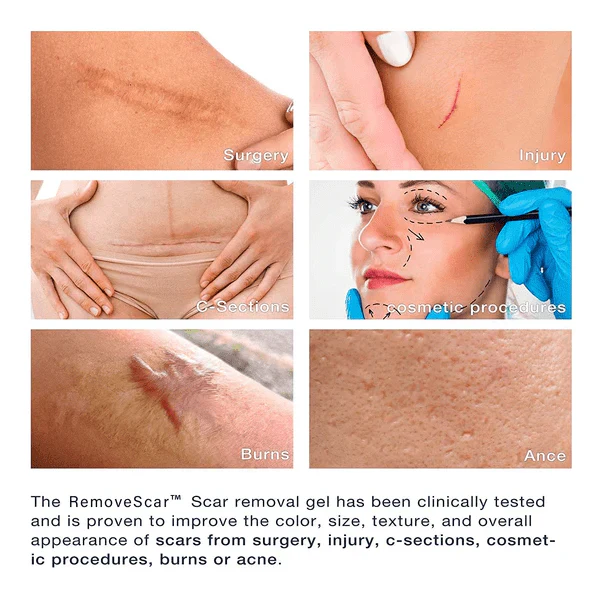 Aprolo™ German Advanced Skin Renewal Gel - Image 6