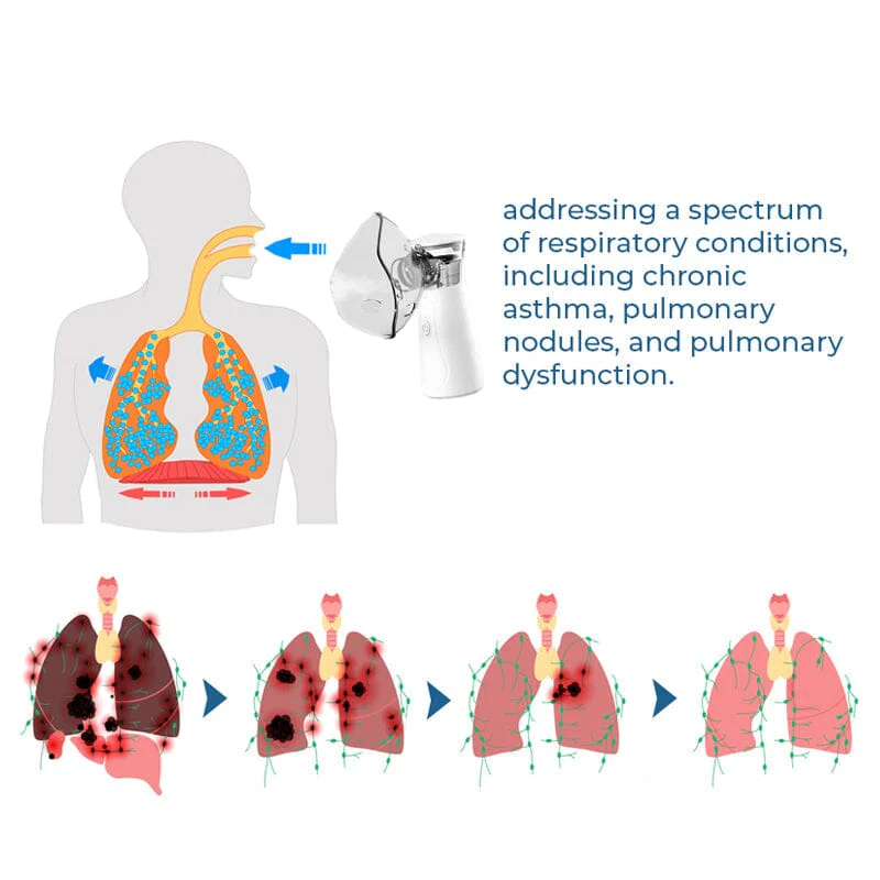 GFOUK™ LungDetox Nebulizer Cleansing Spray - Image 5