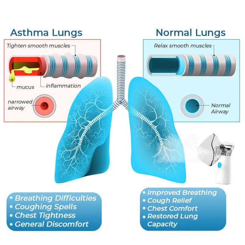 GFOUK™ LungDetox Nebulizer Cleansing Spray - Image 6