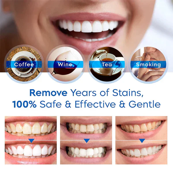 Teeth Whitening Essence - Image 4